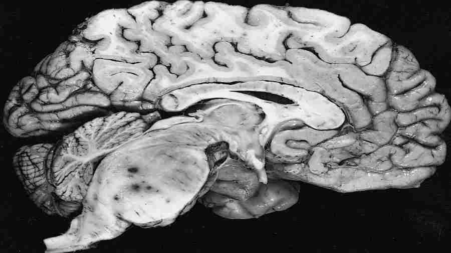 Previously unknown tubules between the skull and brain discovered